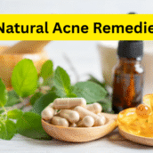 Natural Acne Remedies: Botanicals, Probiotics, and DIY Routines That Work