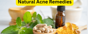 Natural Acne Remedies: Botanicals, Probiotics, and DIY Routines That Work