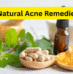 Natural Acne Remedies: Botanicals, Probiotics, and DIY Routines That Work