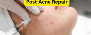 Post-Acne Repair: How to Fade Scars and Hyperpigmentation Fast