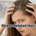 Stress-Related Hair Loss: Dermatologist-Approved Treatments to Stop Shedding